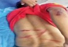 MLA रेस्ट हाउस के बाहर आधी रात हंगामा, विधायक पुत्र की शिकायत पर गिरफ्तारी, दूसरे पक्ष ने पुलिस पर उठाए सवाल